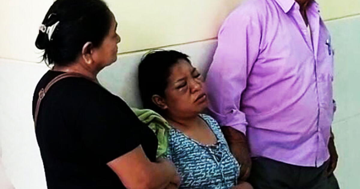 Tumbes Mujer Termina Con El Rostro Desfigurado Tras Agresi N De Su