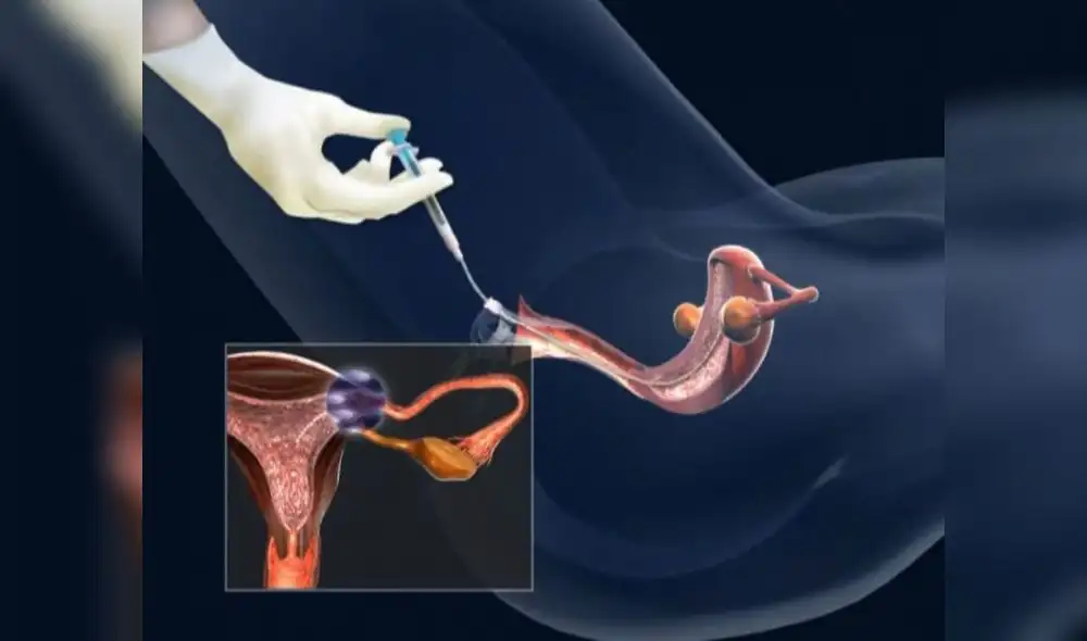 Cada vez más mujeres en el mundo recurren a un banco de semen para cumplir su sueño de ser mamás solteras. Foto: Difusión.