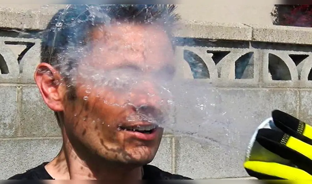 YouTube viral: se arrojó nitrógeno líquido en la cara y ahora luce así [VIDEO]