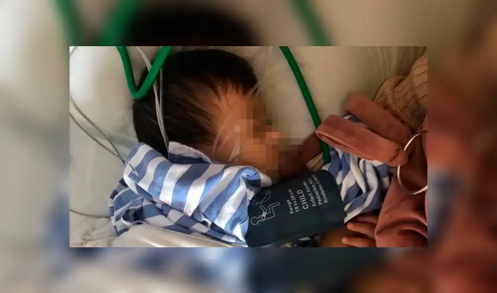 Bebé se tragó 14 bolitas magnéticas que le generaron severas lesiones