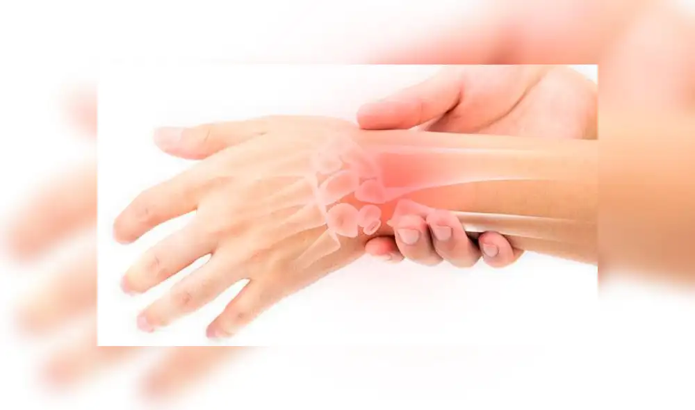 Reportan caso sospechoso de síndrome Guillain-Barré en Puno