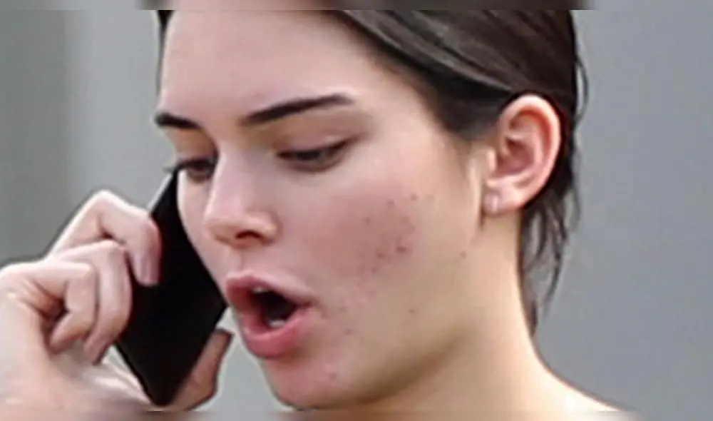 La modelo Kendall Jenner sufre por secuelas del acné en su rostro. Fuente: Instagram