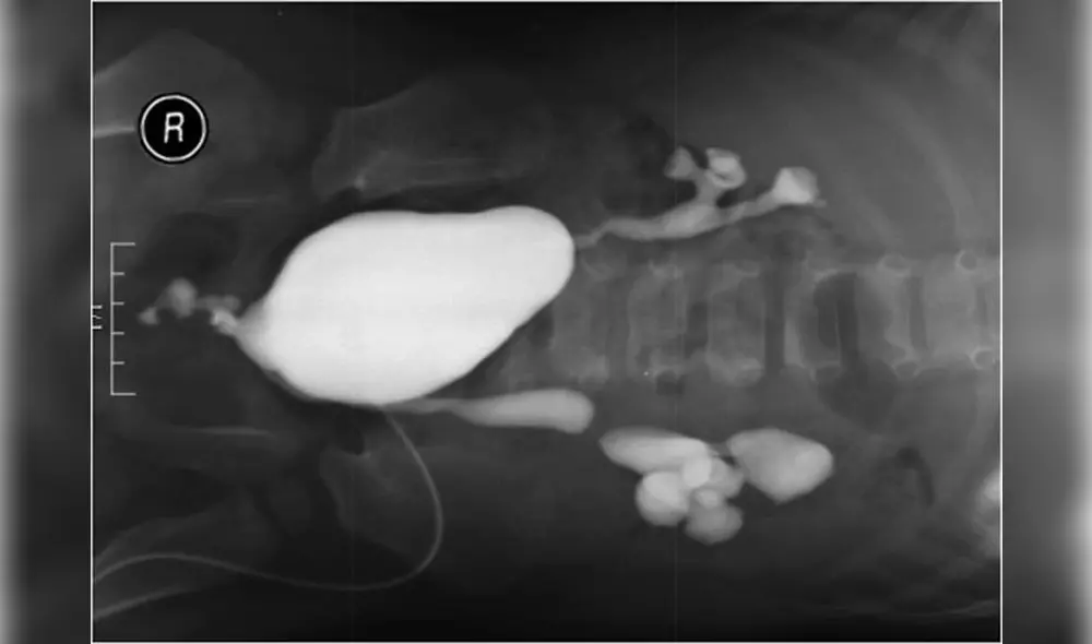 El nacimiento de un bebé sin pene conmociona al mundo de la medicina. Foto: Difusión. El nacimiento de un bebé sin pene conmociona al mundo de la medicina. Foto: Difusión.