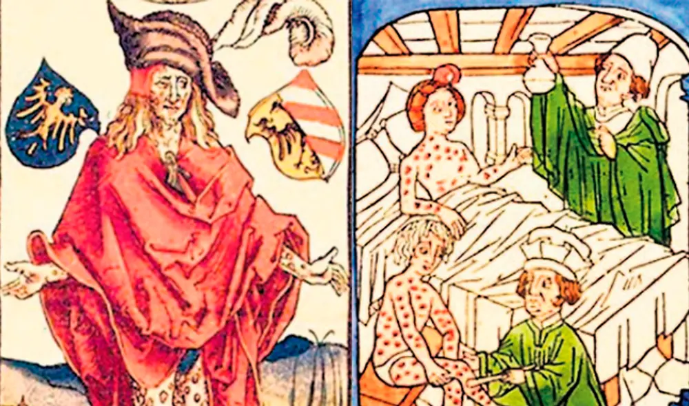 Grabado europeo. A la izquierda Marte (guerra), Venus (sexo) y mercurio (tratamiento). A la derecha Cataplasma con Mercurio. Curaba las bubas pero terminaba por envenenar al paciente