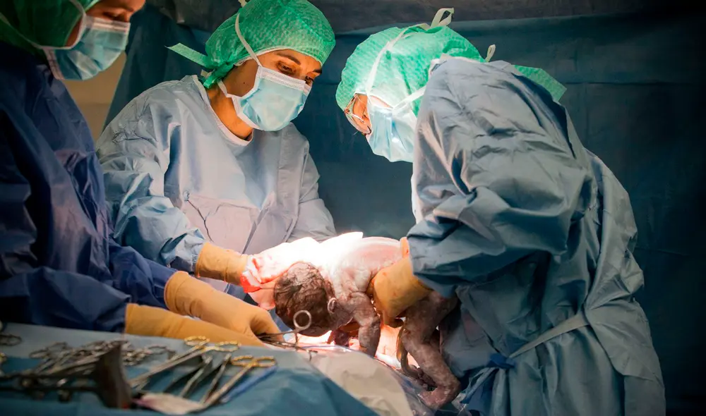 La madre llevó el ovillo de gasa en su organismo durante más de dos años, hasta que se lo descubrieron en 2011. Foto: El País La madre llevó el ovillo de gasa en su organismo durante más de dos años, hasta que se lo descubrieron en 2011. Foto: El País