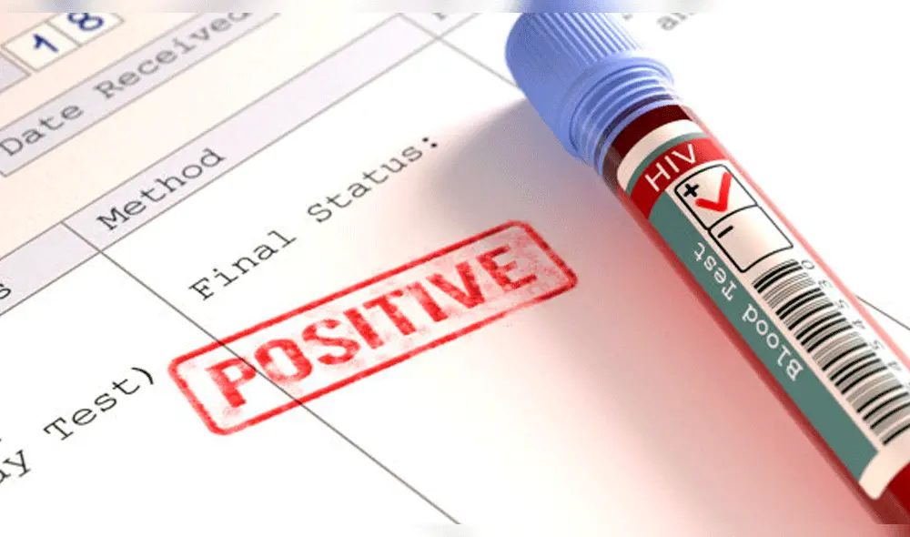 VIH: origen, historia y línea de tiempo de la enfermedad que afecta a millones