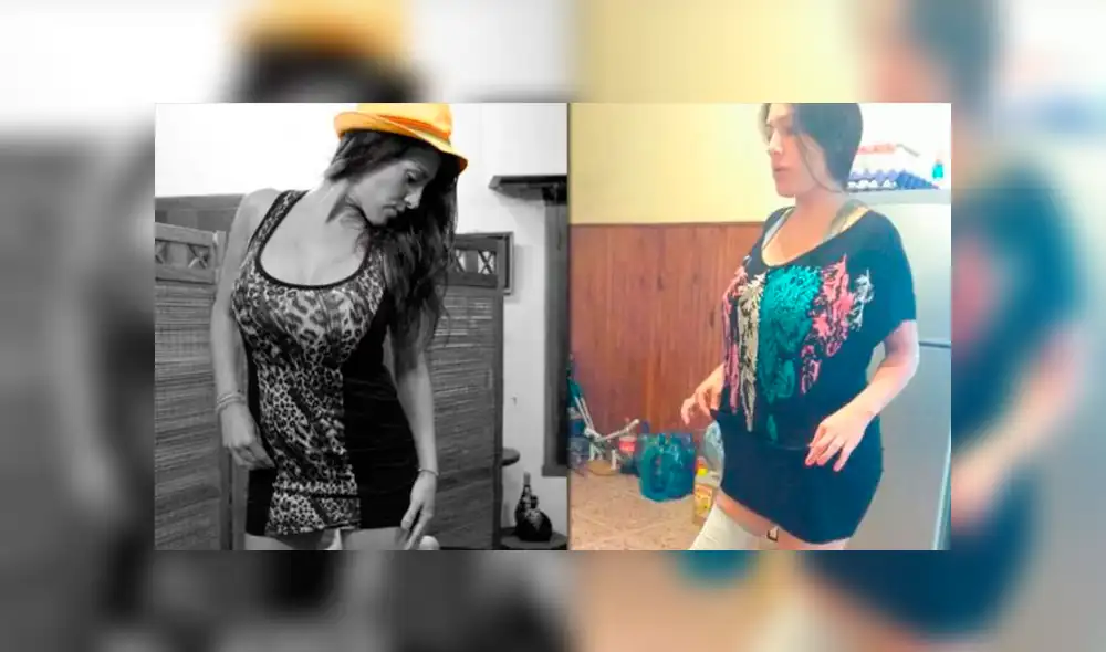 Acudió a clínica por una liposucción y terminaron apuntándole la pierna Acudió a clínica por una liposucción y terminaron apuntándole la pierna