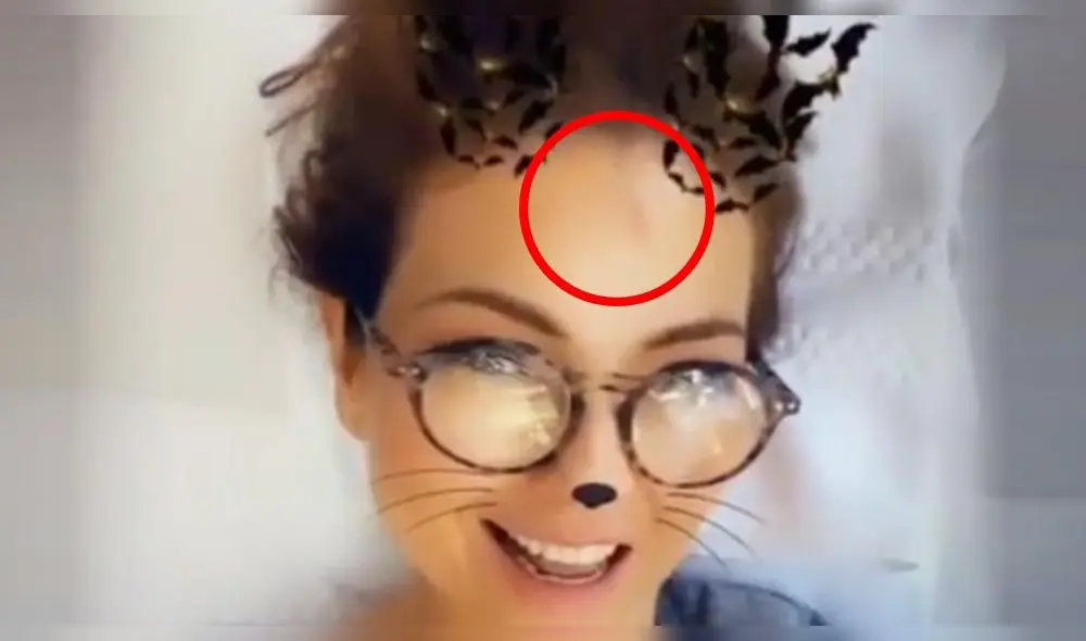 Thalía sufre por terrible quemadura que dañó su rostro [VIDEO]