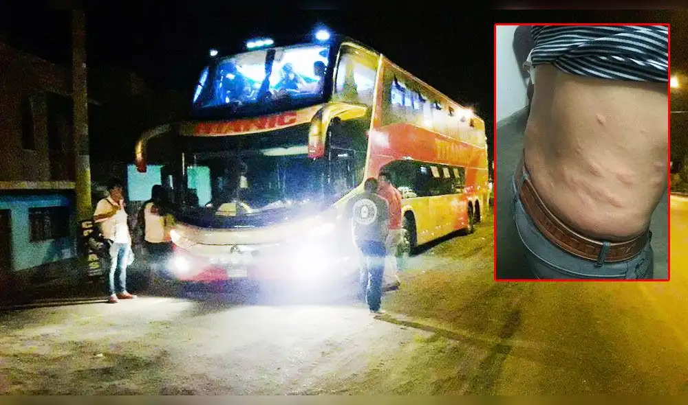 Pasajeros sufrieron picaduras de chinches durante viaje de Chiclayo a Lima