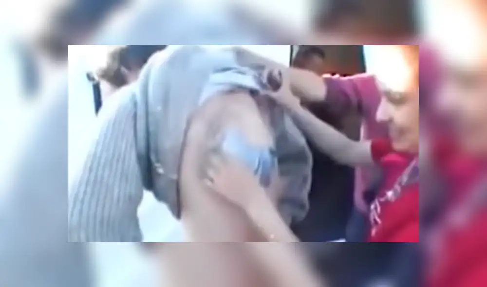 Facebook viral: misteriosas criaturas vivían dentro de la espalda de un joven sin que él lo sepa [VIDEO]