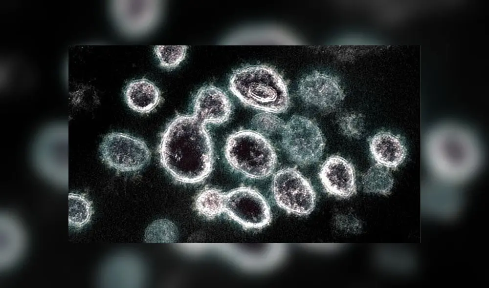 Partículas del SARS-CoV-2 bajo microscopio electrónico. Crédito: NIAID.