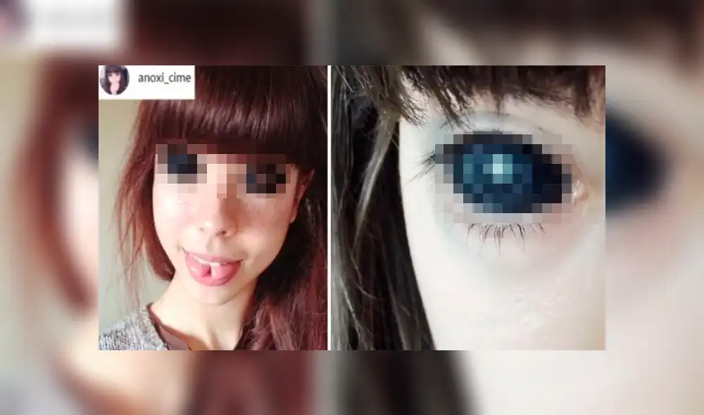 Joven quedó ciega tras tatuarse los ojos de negro [FOTOS] 