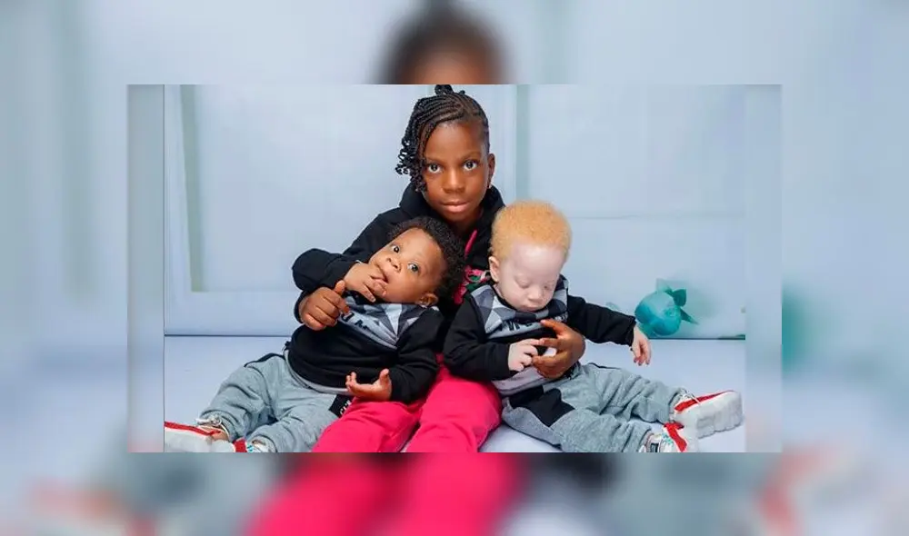 Bebés mellizos con diferente color de piel y cabello sorprenden al mundo [FOTOS]