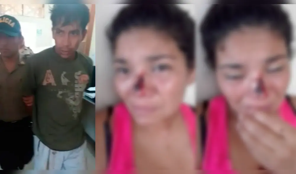 Desfigura el rostro a su expareja porque no quiso regresar con él en Nuevo Chimbote