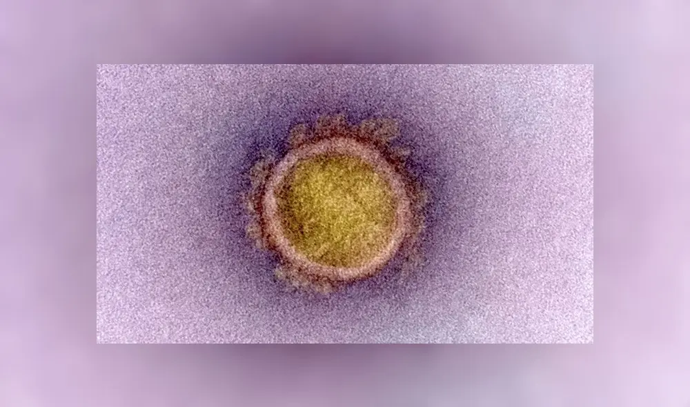 Partícula de SARS-CoV-2. Crédito: NIAID.