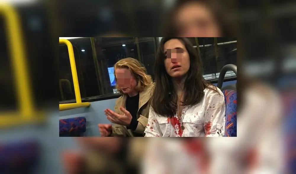 Golpeadas y desangradas porque no aceptaron darse un beso: la atroz agresión a pareja de lesbianas