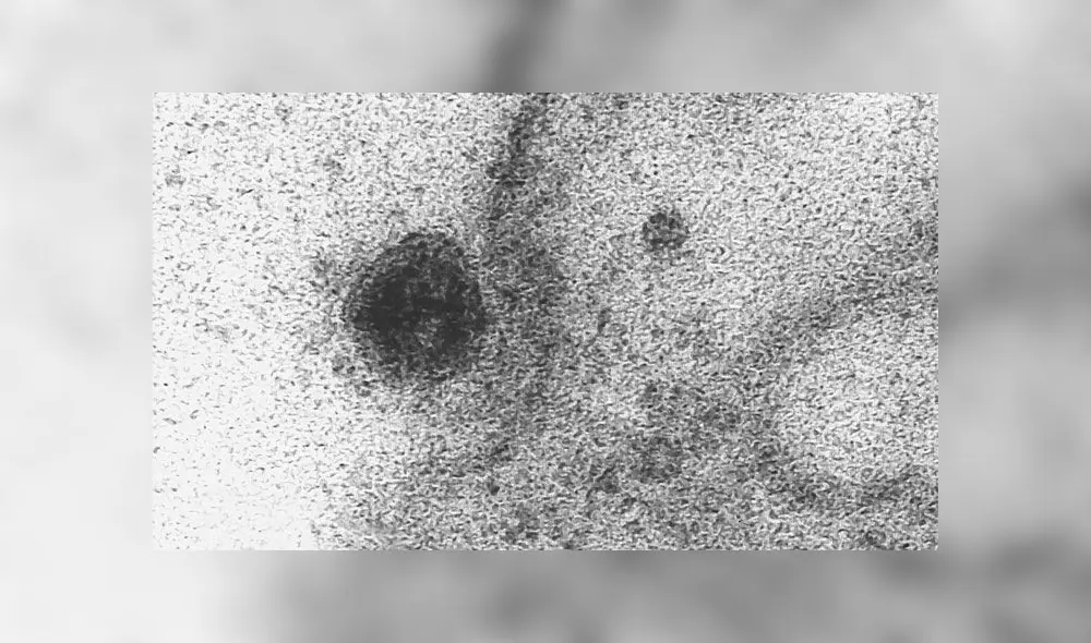 Imagen del coronavirus infectando una célula humana. Fuente: IOC / Fiocruz. Imagen del coronavirus infectando una célula humana. Fuente: IOC / Fiocruz.