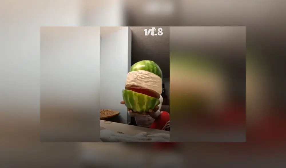 Desliza las imágenes para ver el terrible resultado que obtuvo un joven al hacer un experimento casero. Foto: VT Desliza las imágenes para ver el terrible resultado que obtuvo un joven al hacer un experimento casero. Foto: VT