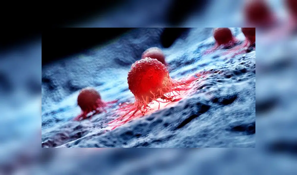 Cada 4 de febrero se conmeroa el Día Mundial de la lucha contra el Cáncer. Foto: Difusión. Cada 4 de febrero se conmeroa el Día Mundial de la lucha contra el Cáncer. Foto: Difusión.