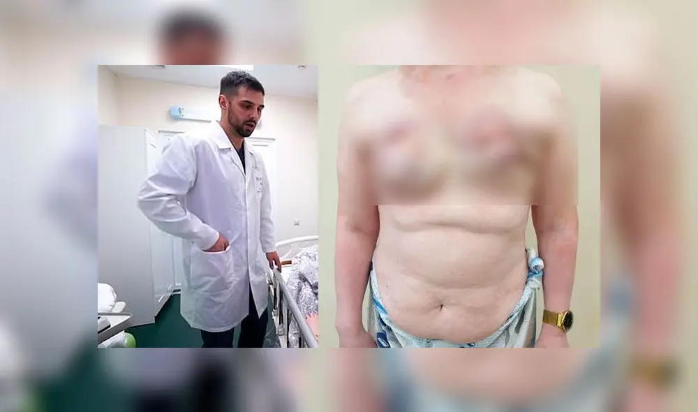 Le inyectaron vaselina en sus senos por 6 dólares y terminaron extirpándolos [VIDEO]