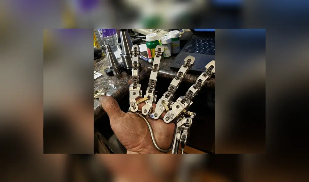 El hombre decidió hacerse una prótesis para la mano luego de que le amputaran cuatro dedos. Foto: Instagram El hombre decidió hacerse una prótesis para la mano luego de que le amputaran cuatro dedos. Foto: Instagram