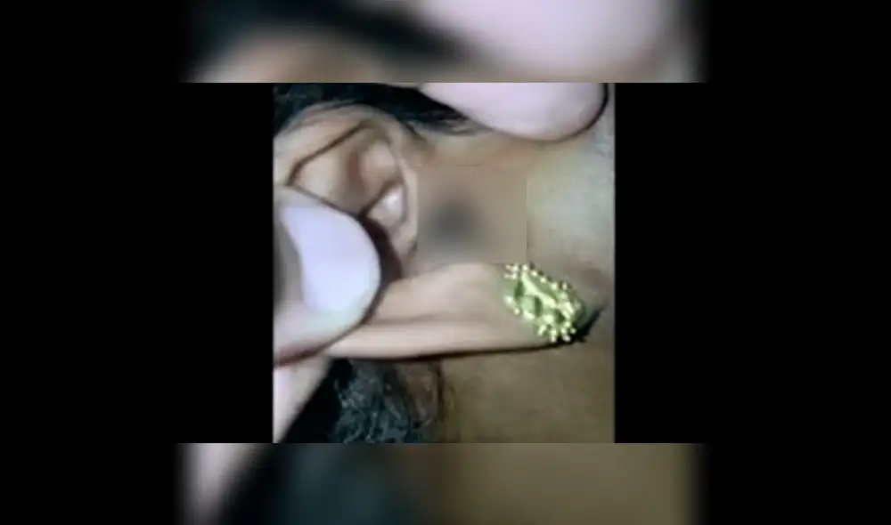 En YouTube, visitó al doctor por dolores de cabeza y le encontraron algo terrible en el oído [VIDEO]