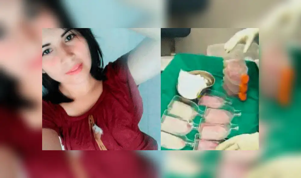 Eyvi Ágreda necesitará que su piel sana sea cultivada en el Instituto Nacional de Salud del Niño [VIDEO]