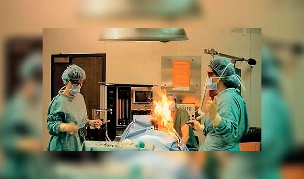 Médicos incendian accidentalmente a paciente con cáncer durante intervención quirúrgica 