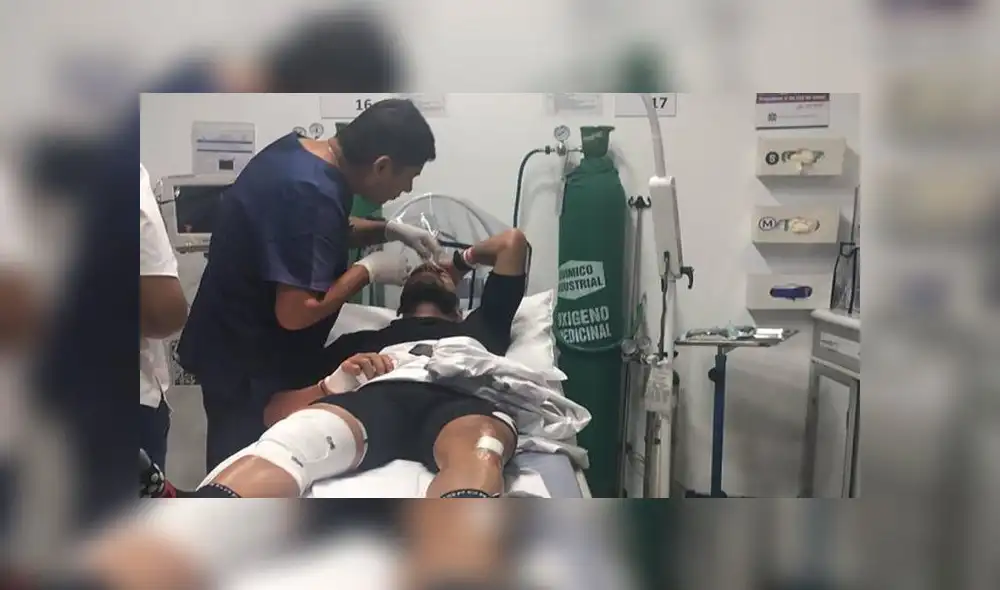 Taxista atropelló a extenista Luis Horna cuando manejaba su bicicleta en La Molina