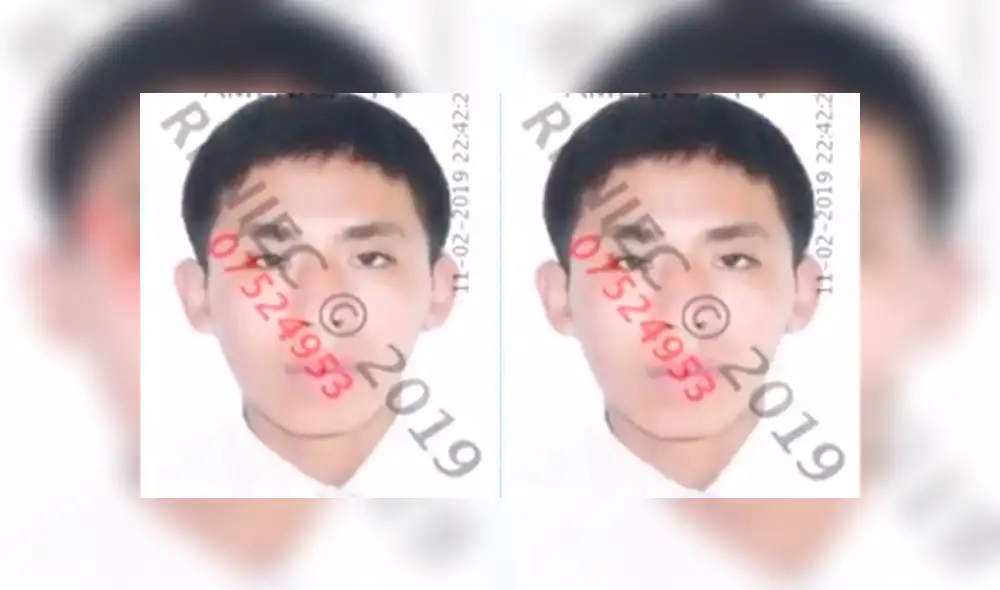 Mujer recibe 60 puntos en el rostro tras ser atacada por su pareja [VIDEO]