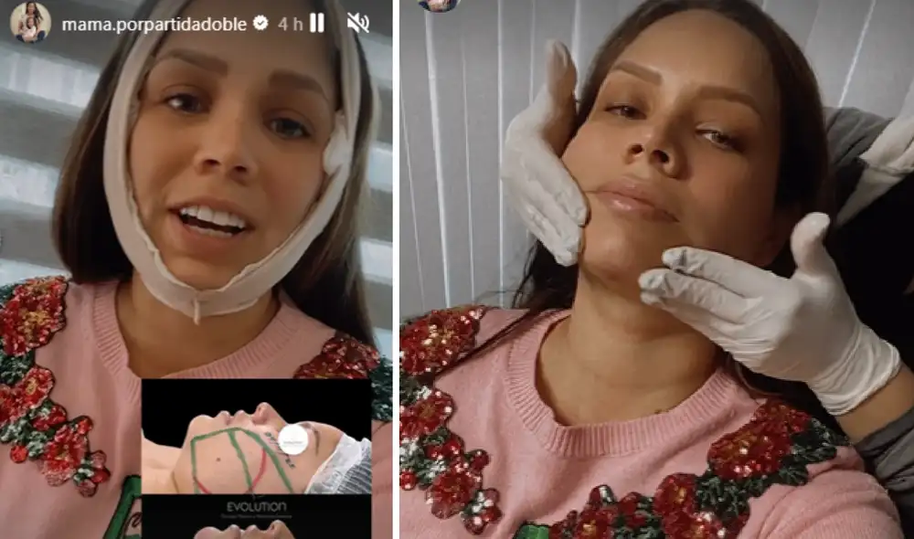 Andrea San Martín se operó el rostro. Foto: Andrea San Martín/Instagram