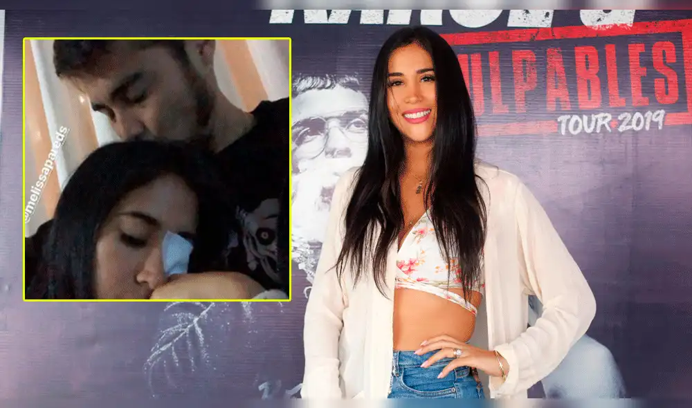 Así luce Melissa Paredes tras sufrir accidente en el rostro  [VIDEO]