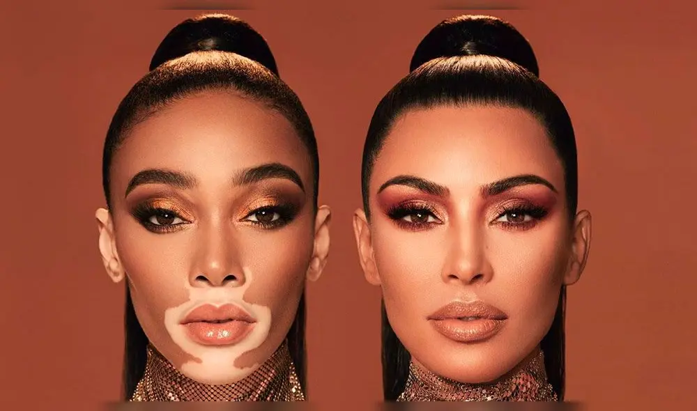 Kim Kardashian y Winnie Harlow