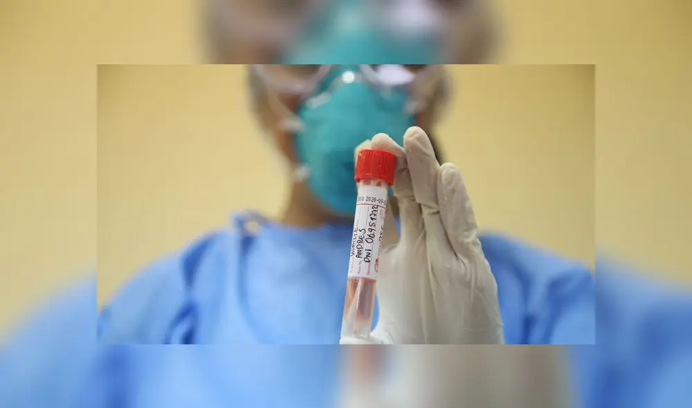 Iquitos: primer caso de coronavirus en la Selva Peruana. Créditos: Andina. Iquitos: primer caso de coronavirus en la Selva Peruana. Créditos: Andina.