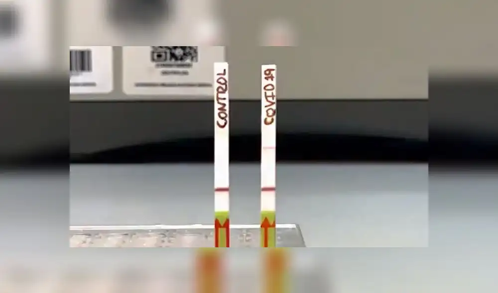 Pruebas rápidas moleculares. Créditos: Twitter de Eduardo Málaga Trillo