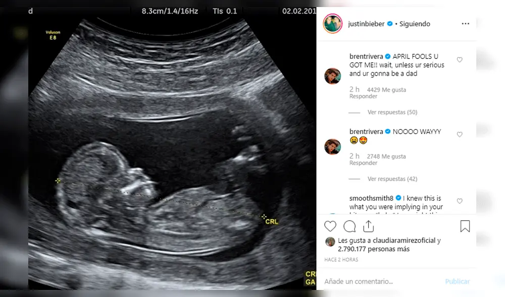 ¿Justin Bieber y Hailey Baldwin serán padres? Ecografía alborotó las redes