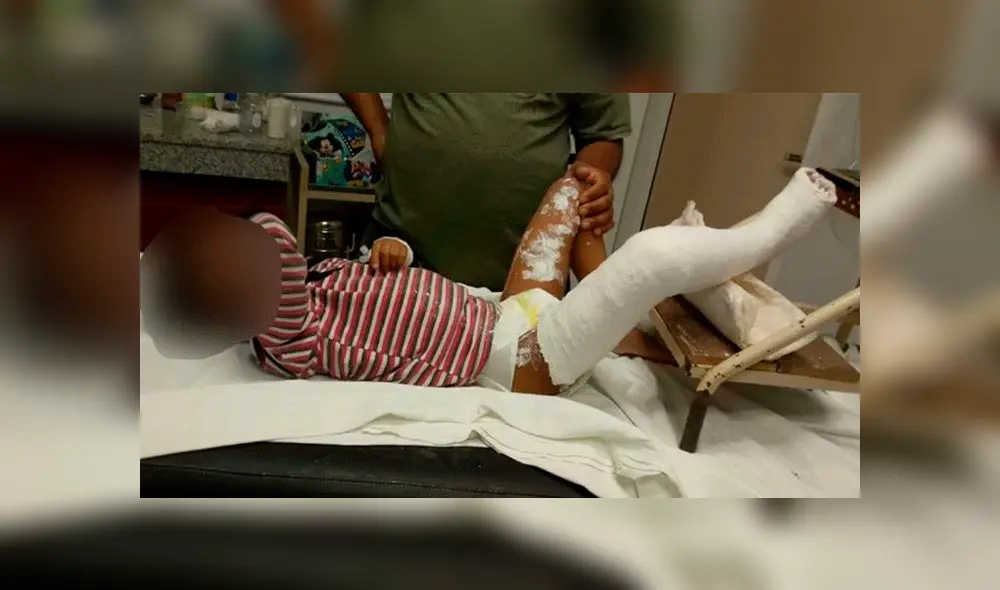 Una reja de más de 80 kg cae sobre un niño: “Bruno está vivo de milagro”