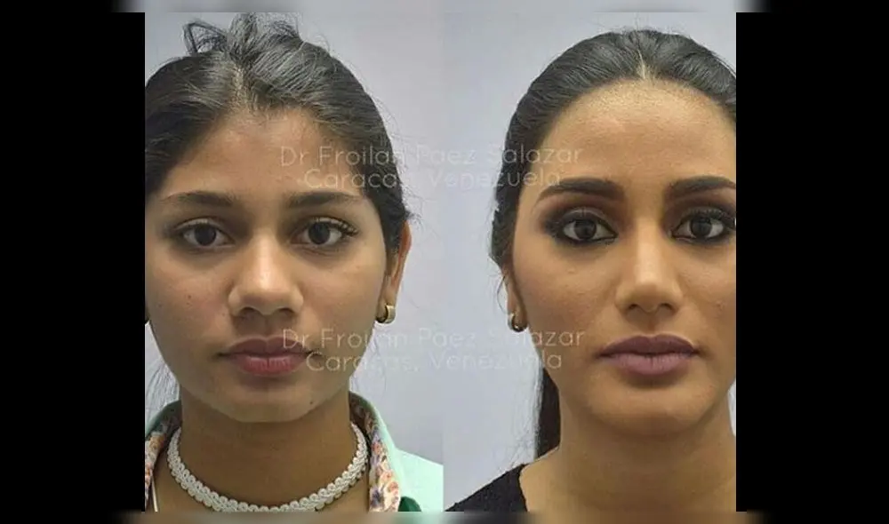 Miss Venezuela expuesta en redes con fotos antes de sus cirugías [FOTOS]