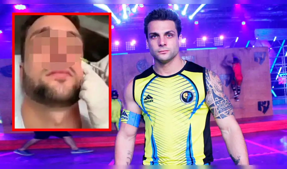 Nicola Porcella se opera el rostro para regresar a "Esto es guerra"