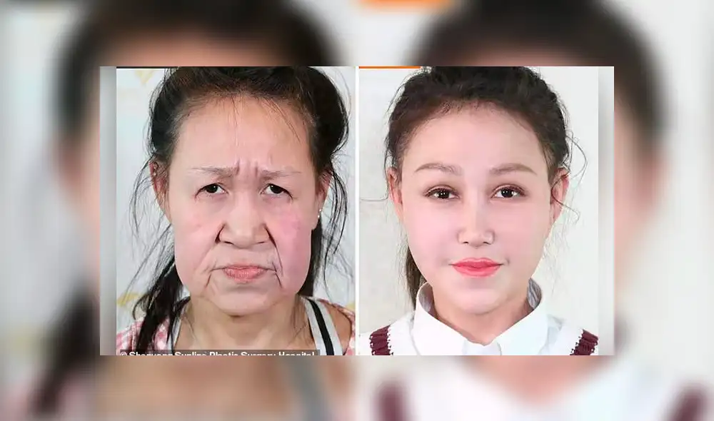 Video es viral en Facebook. La joven padecía ‘progeria’, una rara enfermedad genética que la hace ver como una mujer de unos 60 años