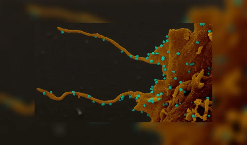 Imagen microscópica de las céluas renales de un mono africano infectado con SARS-CoV-2. Foto: NIH