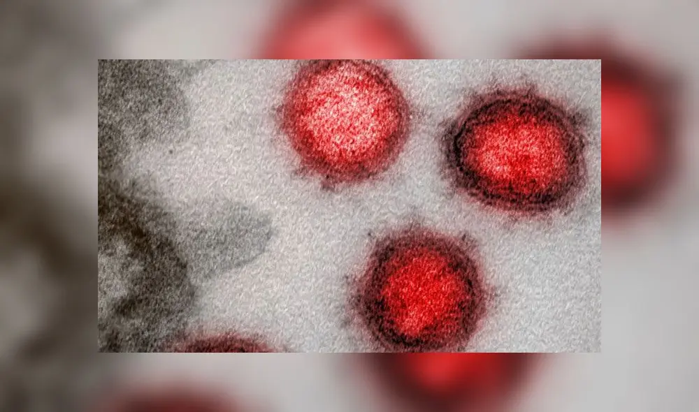 Imagen del coronavirus obtenida con microscopio electrónico. Crédito: NIAID. Imagen del coronavirus obtenida con microscopio electrónico. Crédito: NIAID.