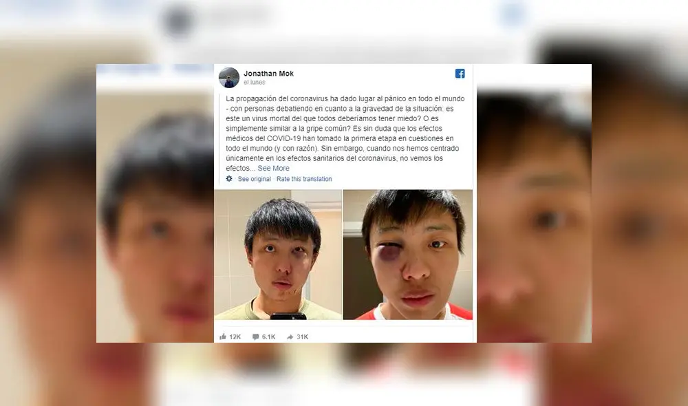 “No quiero tu coronavirus en mi país”: joven asiático sufre brutal golpiza en Inglaterra [FOTO]