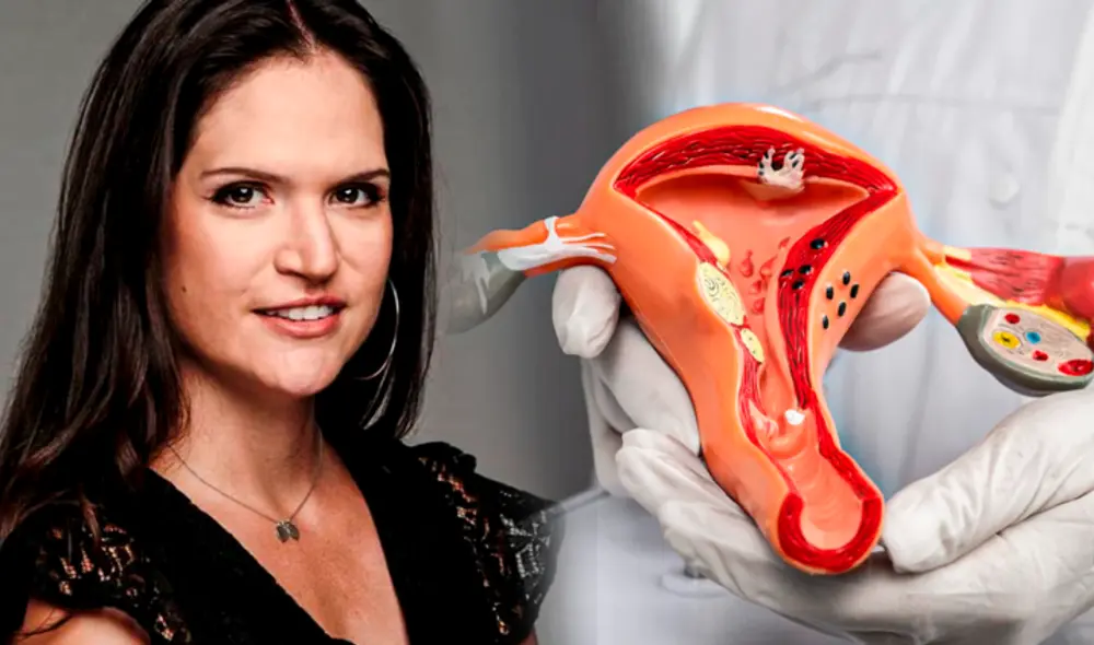 Lorena Álvarez reveló que se tuvo que operar por la endiometriosis. Composición de Jasmin Ceras/La República