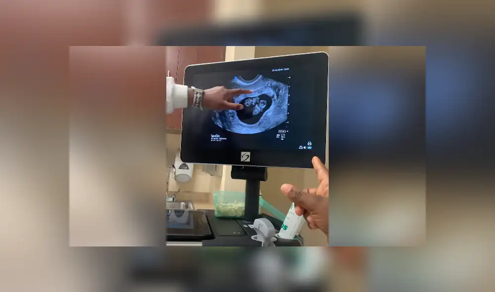 La mujer se emocionó luego de que le dijeran que iba a tener gemelos. Foto: YouTube La mujer se emocionó luego de que le dijeran que iba a tener gemelos. Foto: YouTube