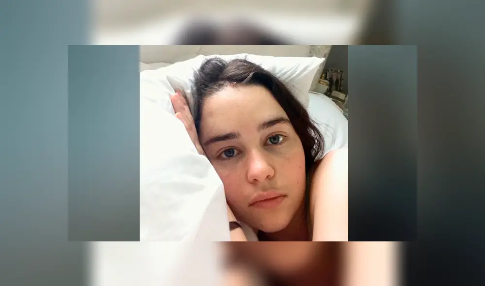 Emilia Clarke comparte fotos de su postoperación por aneurisma cerebral