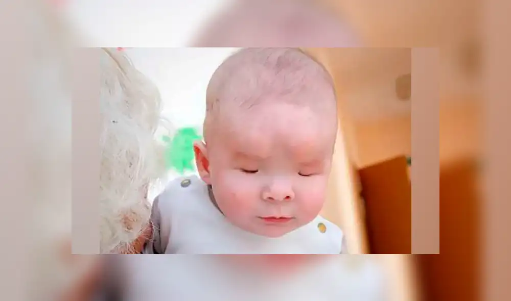 Bebé que nació sin ojos encuentra familia en Navidad tras ser abandonado por su madre Bebé que nació sin ojos encuentra familia en Navidad tras ser abandonado por su madre