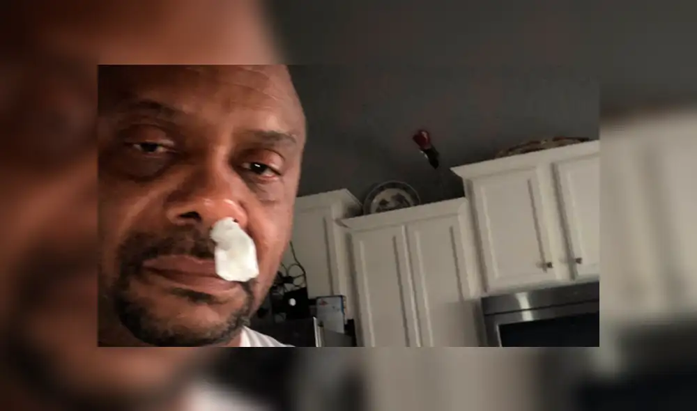 Creyó que tenía una alergia, pero revisión médica reveló amarga realidad