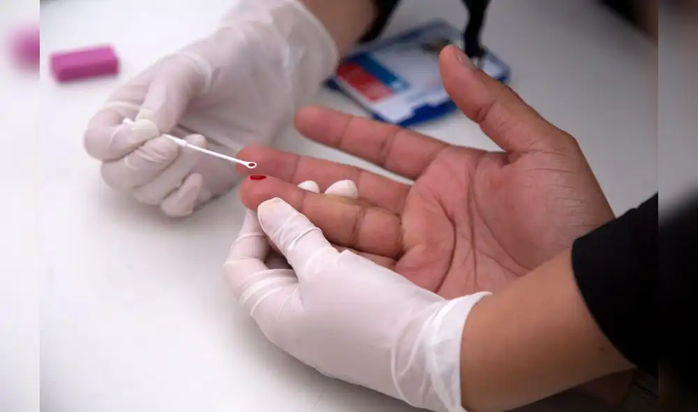 El Día Mundial de la Lucha contra el SIDA se conmemora desde hace 31 años a nivel mundial. Foto: Difusión.