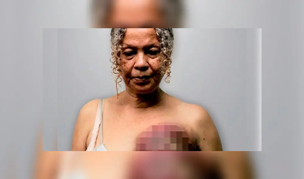 Elizabeth Salazar falleció tras combatir contra un cáncer de mama que la convirtió en símbolo de la lucha por los derechos ante la crisis hospitalaria de Venezuela. Foto: Difusión